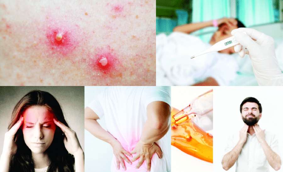 ဆောင်းပါး