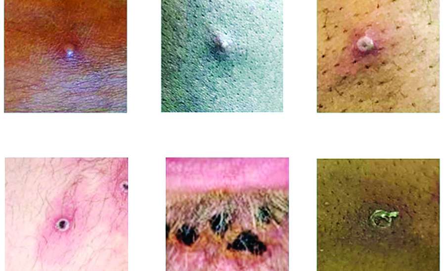 ဆောင်းပါး