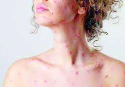 ဆောင်းပါး