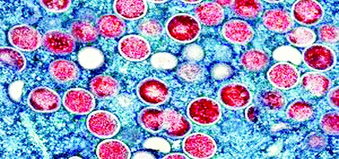 ဆောင်းပါး